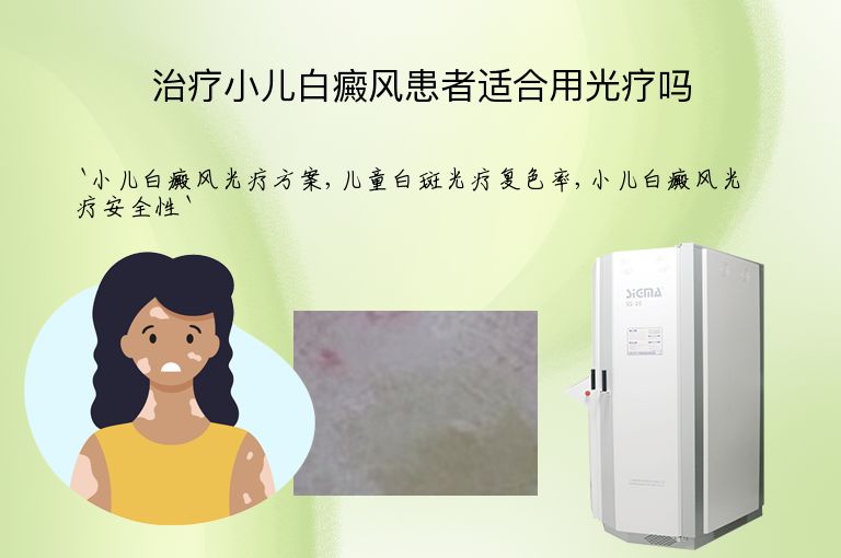 治疗小儿白癜风患者适合用光疗吗