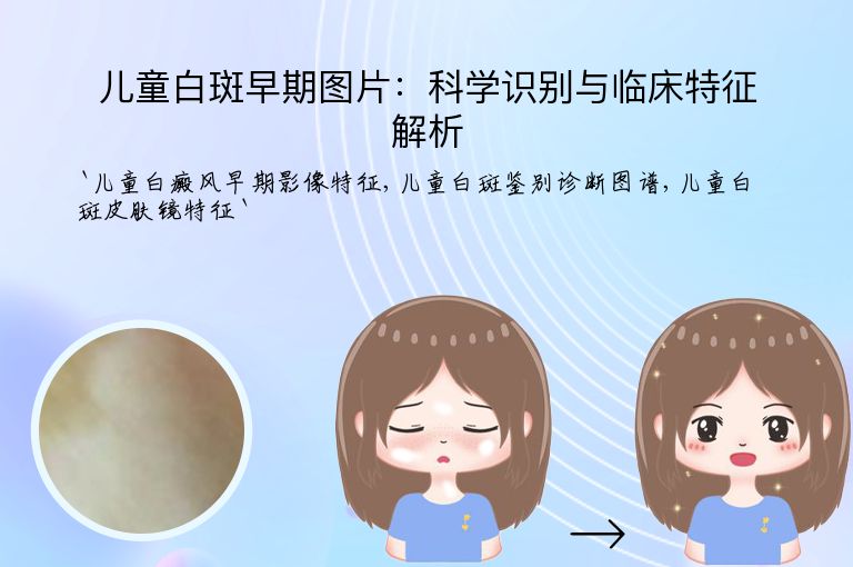 儿童白斑早期图片:科学识别与临床特征解析