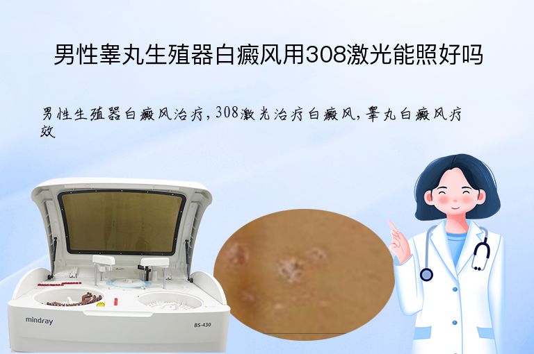 男性睾丸生殖器白癜风用308激光能照好吗”