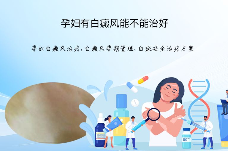 孕妇有白癜风能不能治好”