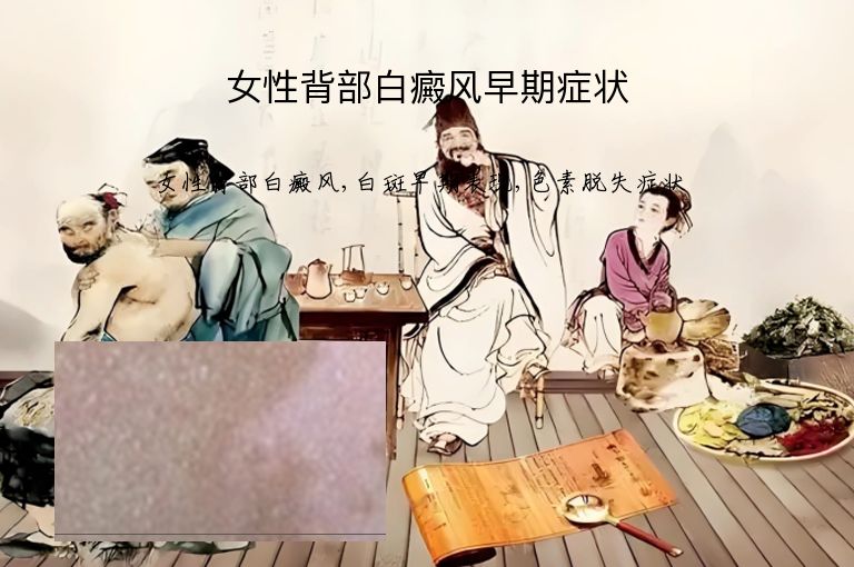 女性背部白癜风早期症状”