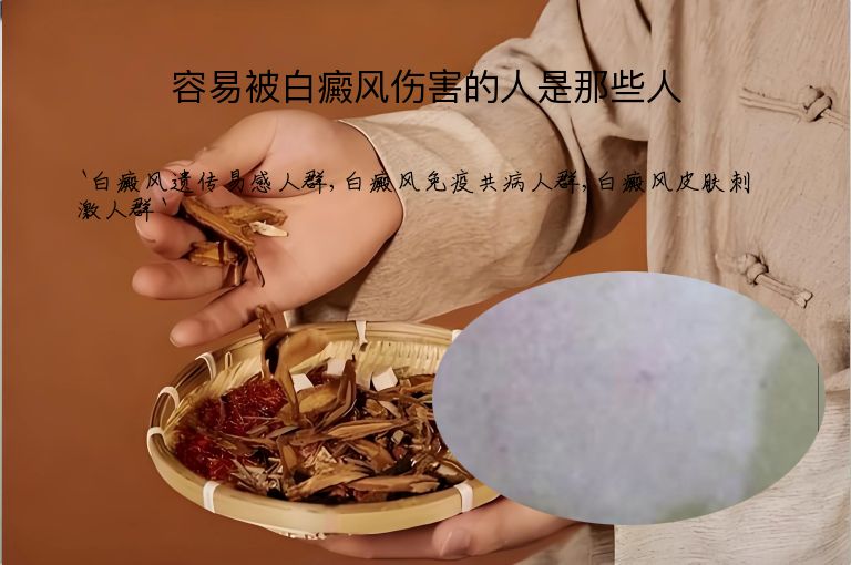 容易被白癜风伤害的人是那些人”