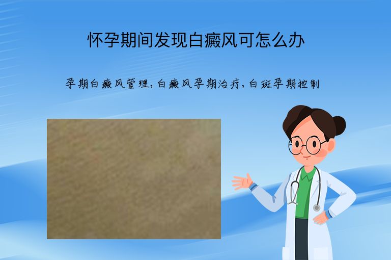 怀孕期间发现白癜风可怎么办”