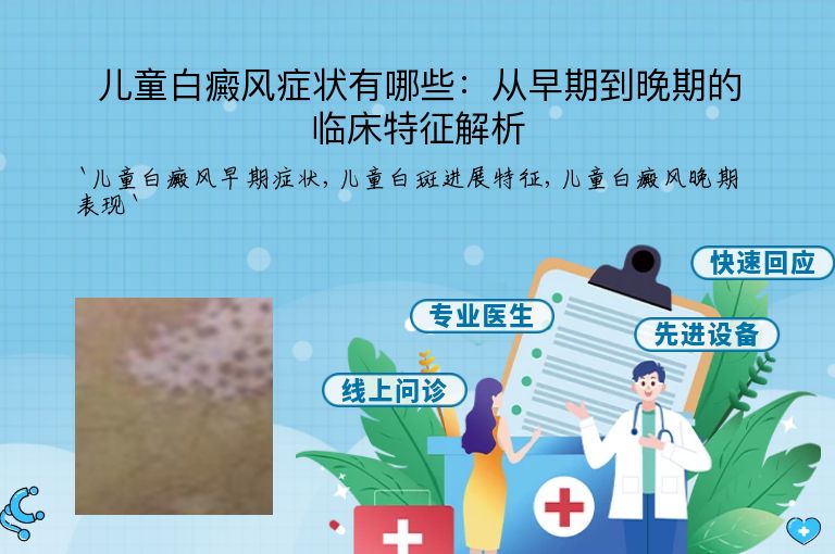 儿童白癜风症状有哪些:从早期到晚期的临床特征解析