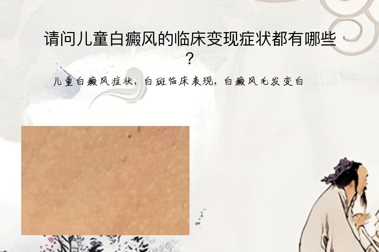 https://www.bdfsjzyy.com/d/file/p/ee76965e606bbf0a2a5d58a8fbf6b042.jpeg