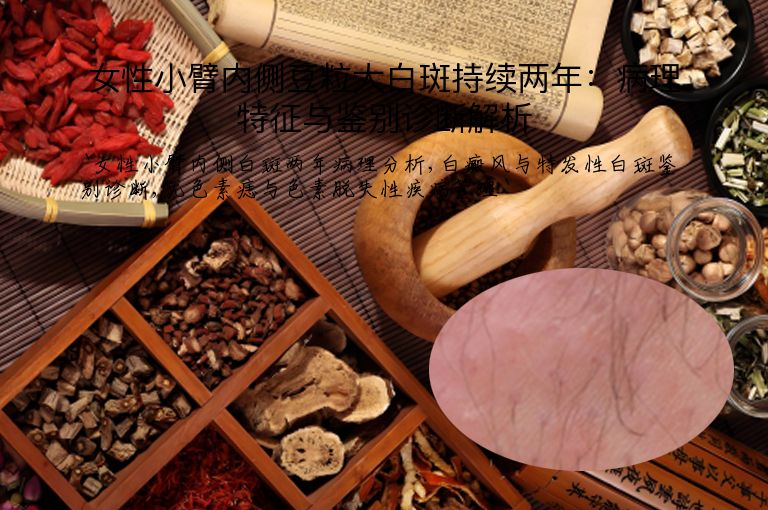 https://www.bdfsjzyy.com/d/file/p/9daf0ba4d207431002e70b547235a1f3.jpeg