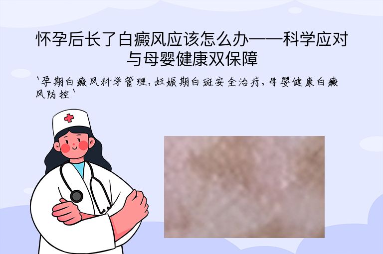 怀孕后长了白癜风应该怎么办——科学应对与母婴健康双保障”