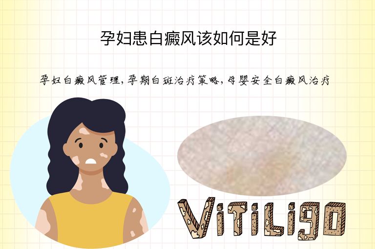 孕妇患白癜风该如何是好”