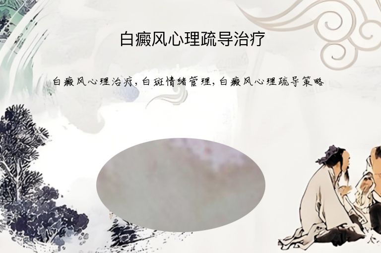 白癜风心理疏导治疗”