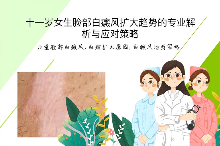 十一岁女生脸部白癜风扩大趋势的专业解析与应对策略”