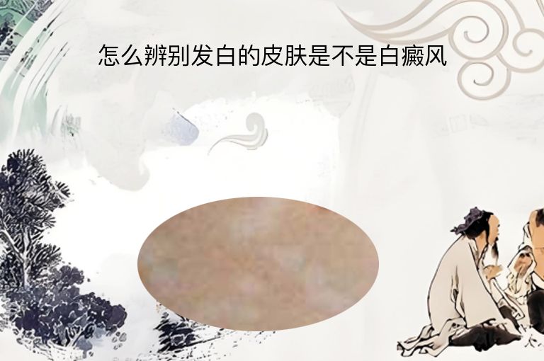 怎么辨别发白的皮肤是不是白癜风”