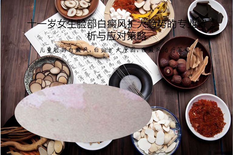 https://www.bdfsjzyy.com/d/file/p/ed649bcc81d1a3eab726e8211014f56e.jpeg