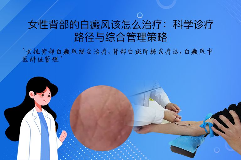 女性背部的白癜风该怎么治疗：科学诊疗路径与综合管理策略