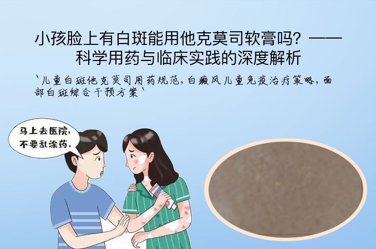 小孩脸上有白斑能用他克莫司软膏吗？——科学用药与临床实践的深度解析”