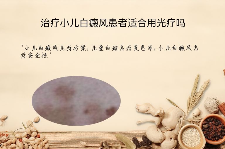 治疗小儿白癜风患者适合用光疗吗
