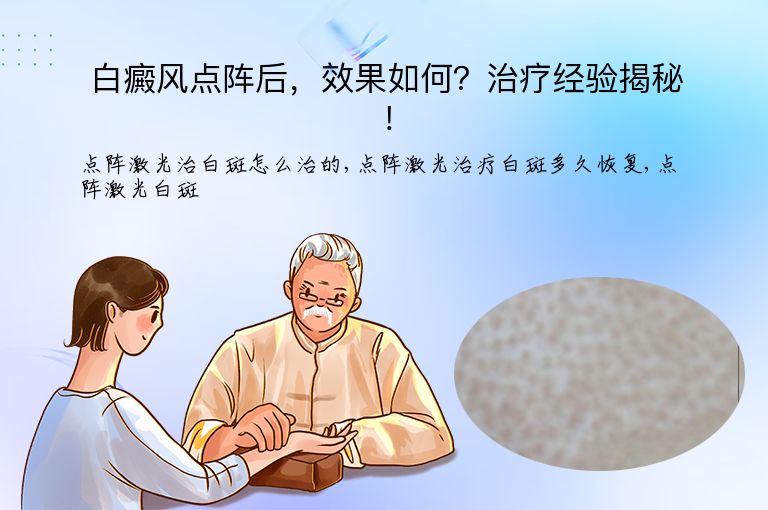 白癜风点阵后，效果如何？治疗经验揭秘！”