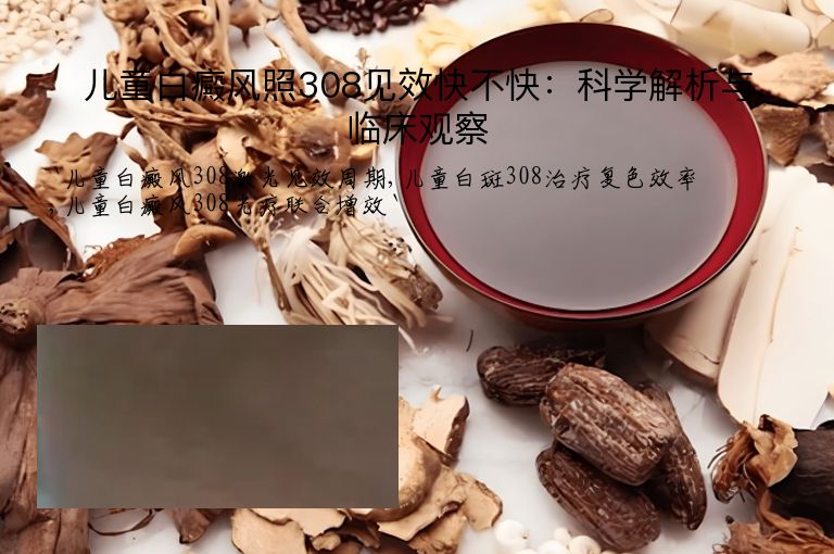 儿童白癜风照308见效快不快:科学解析与临床观察