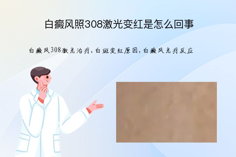白癜风照308激光变红是怎么回事”
