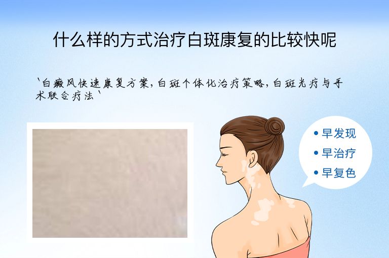 什么样的方式治疗白斑康复的比较快呢