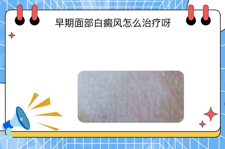 早期面部白癜风怎么治疗呀”