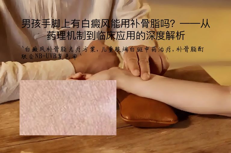 男孩手脚上有白癜风能用补骨脂吗？——从药理机制到临床应用的深度解析