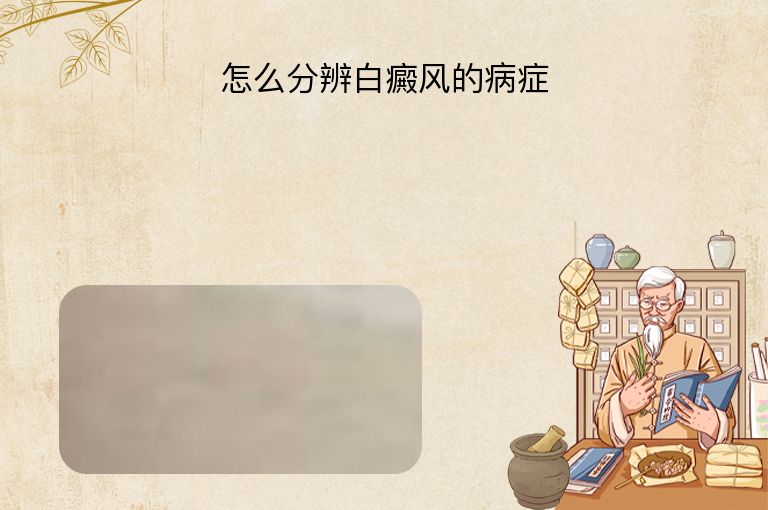 怎么分辨白癜风的病症