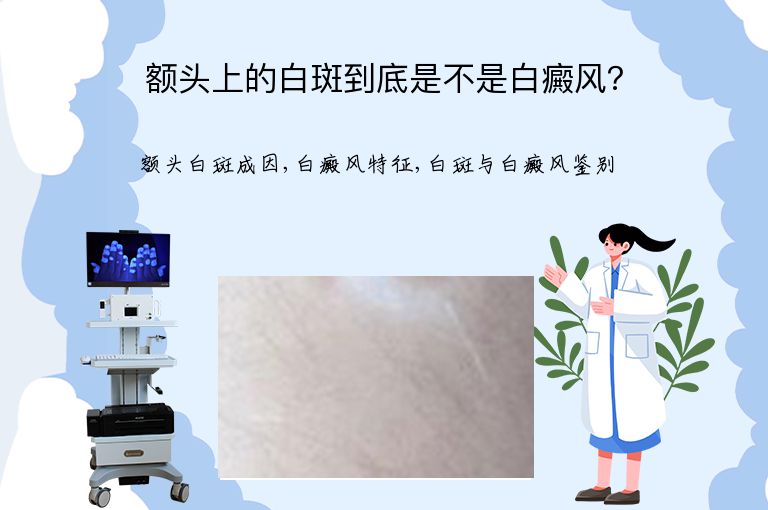 额头上的白斑到底是不是白癜风?”