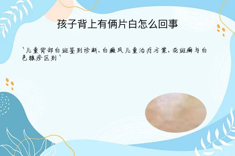 孩子背上有俩片白怎么回事