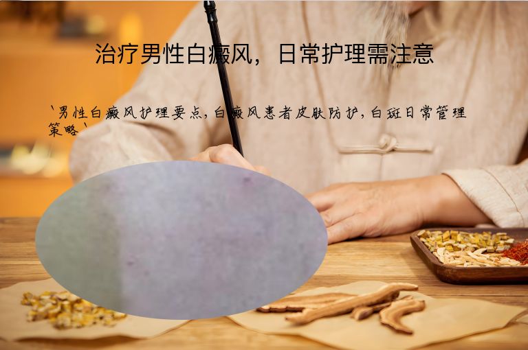 治疗男性白癜风,日常护理需注意