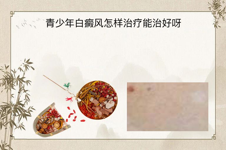 青少年白癜风怎样治疗能治好呀”