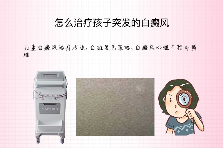 怎么治疗孩子突发的白癜风”