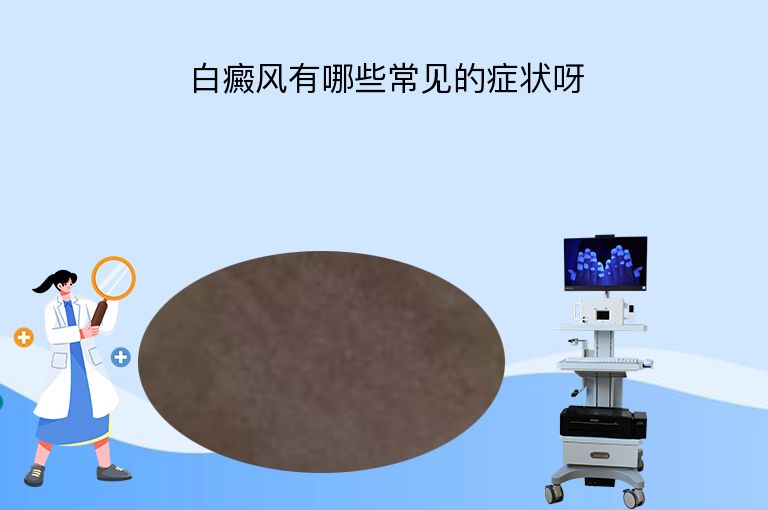 白癜风有哪些常见的症状呀