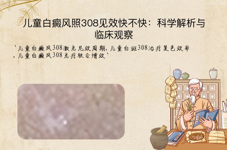 儿童白癜风照308见效快不快：科学解析与临床观察