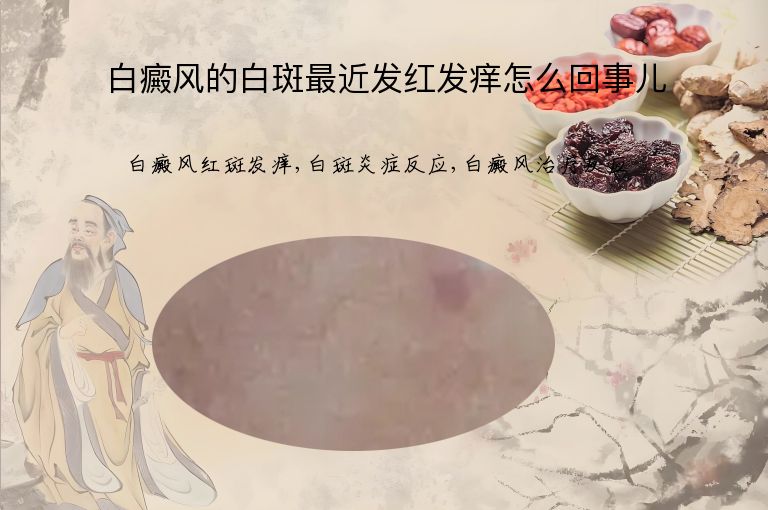 https://www.bdfsjzyy.com/d/file/p/82396162e1860fd663d08b61f45f1a7a.jpeg