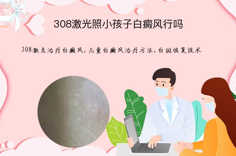 308激光照小孩子白癜风行吗”
