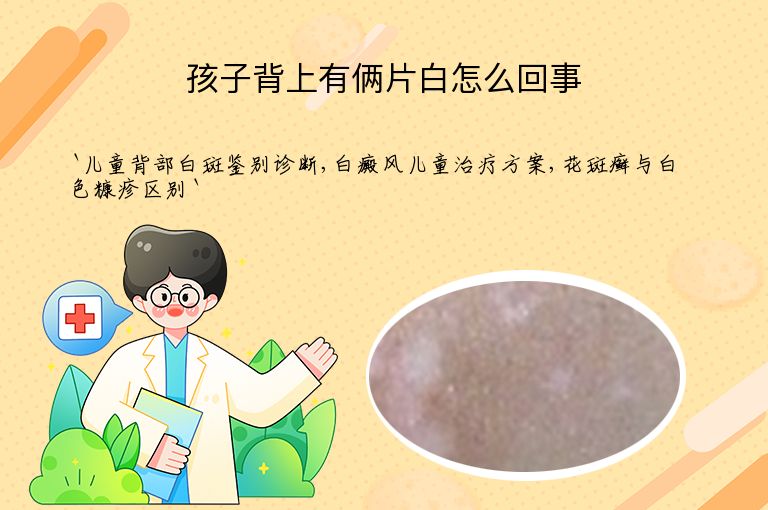 孩子背上有俩片白怎么回事