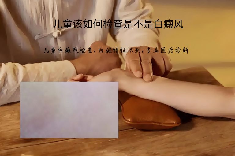 儿童该如何检查是不是白癜风”