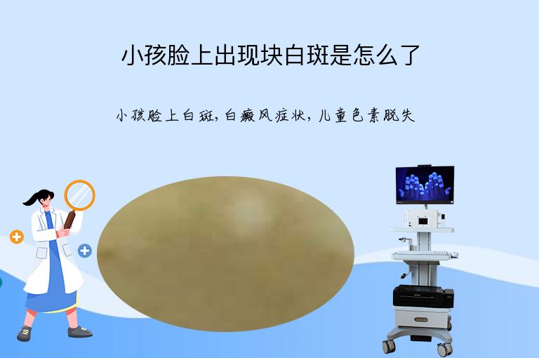 小孩脸上出现块白斑是怎么了”