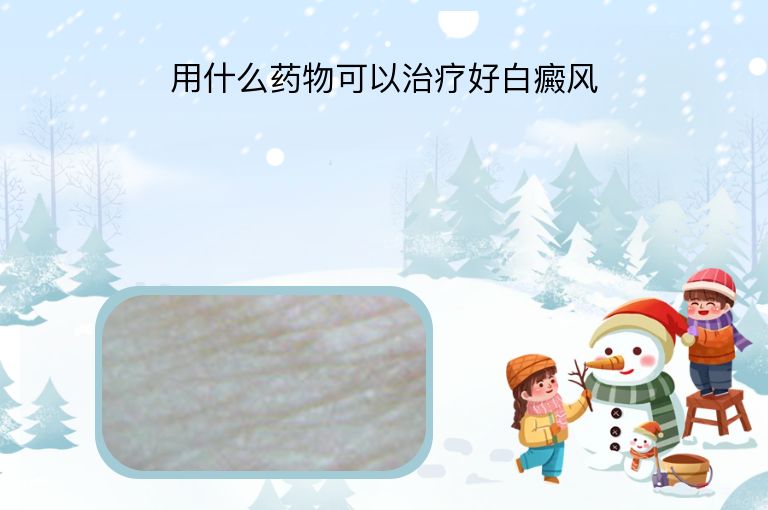 用什么药物可以治疗好白癜风”