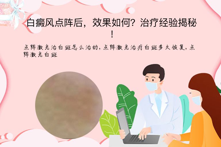https://www.bdfsjzyy.com/d/file/p/06a400283f7083ddb7e536ea350fa8a5.jpeg