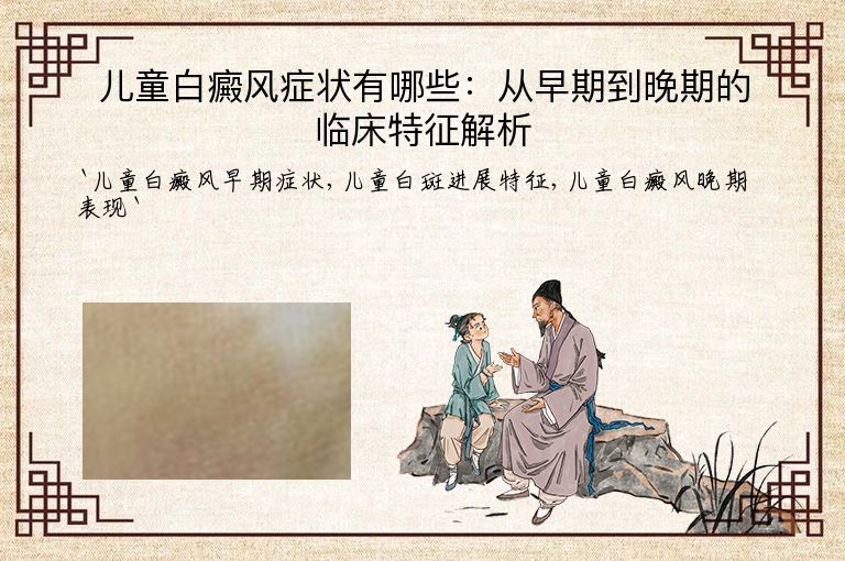 儿童白癜风症状有哪些:从早期到晚期的临床特征解析