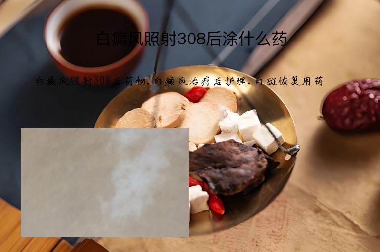 白癜风照射308后涂什么药”