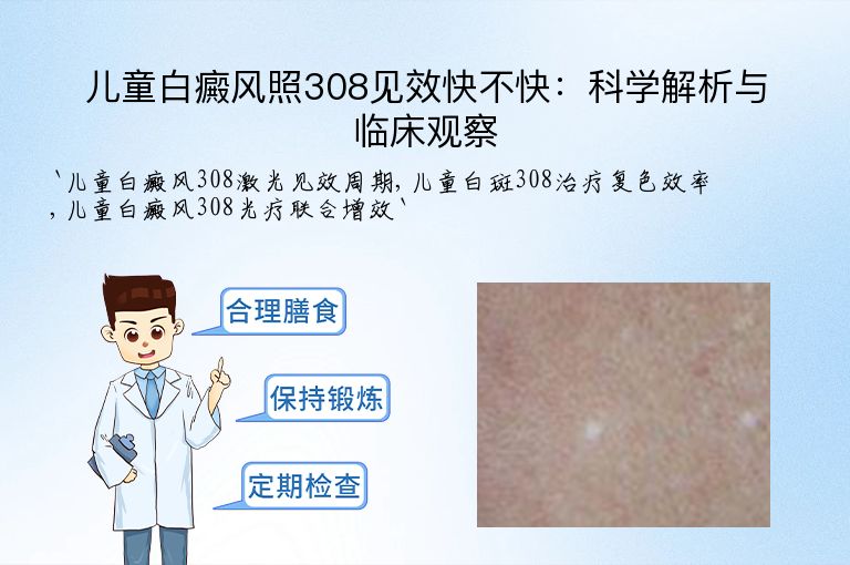 儿童白癜风照308见效快不快:科学解析与临床观察