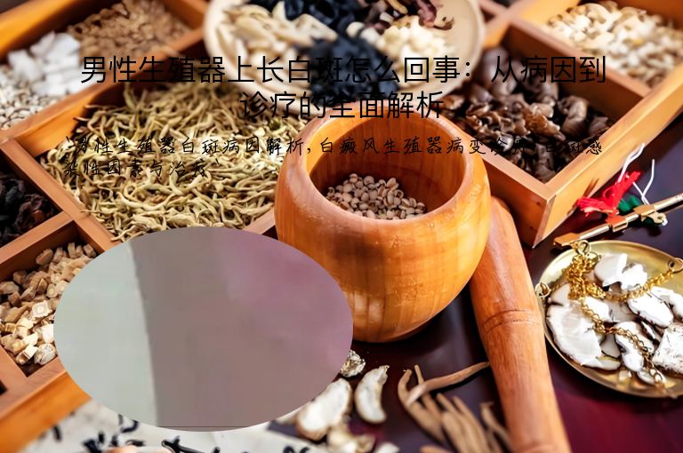 男性生殖器上长白斑怎么回事:从病因到诊疗的全面解析