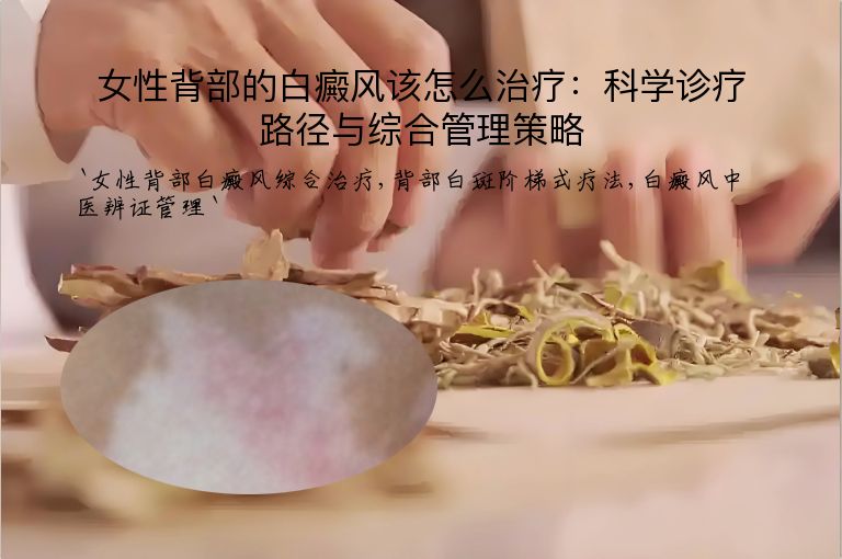 女性背部的白癜风该怎么治疗:科学诊疗路径与综合管理策略