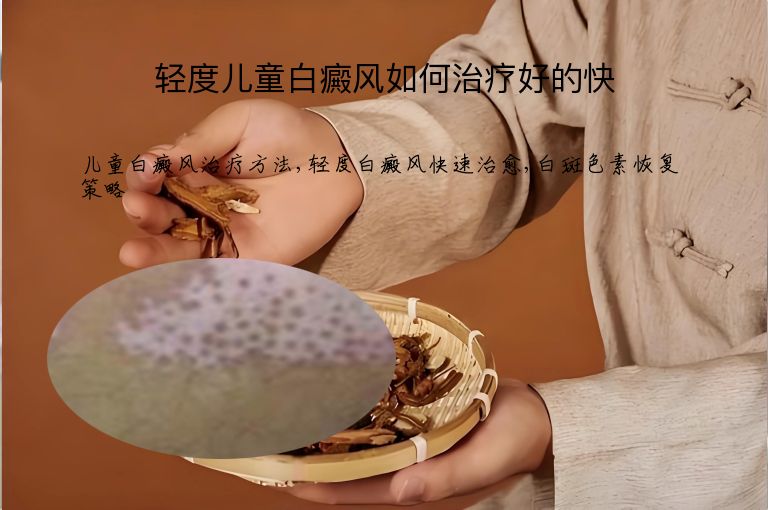 轻度儿童白癜风如何治疗好的快”