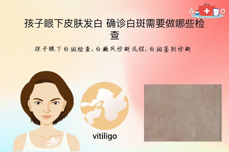 孩子眼下皮肤发白 确诊白斑需要做哪些检查”