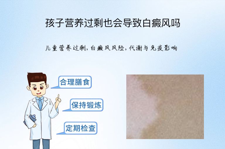 孩子营养过剩也会导致白癜风吗”