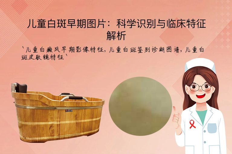 儿童白斑早期图片:科学识别与临床特征解析