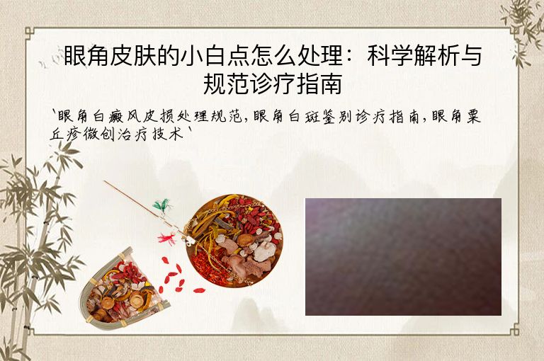 眼角皮肤的小白点怎么处理:科学解析与规范诊疗指南